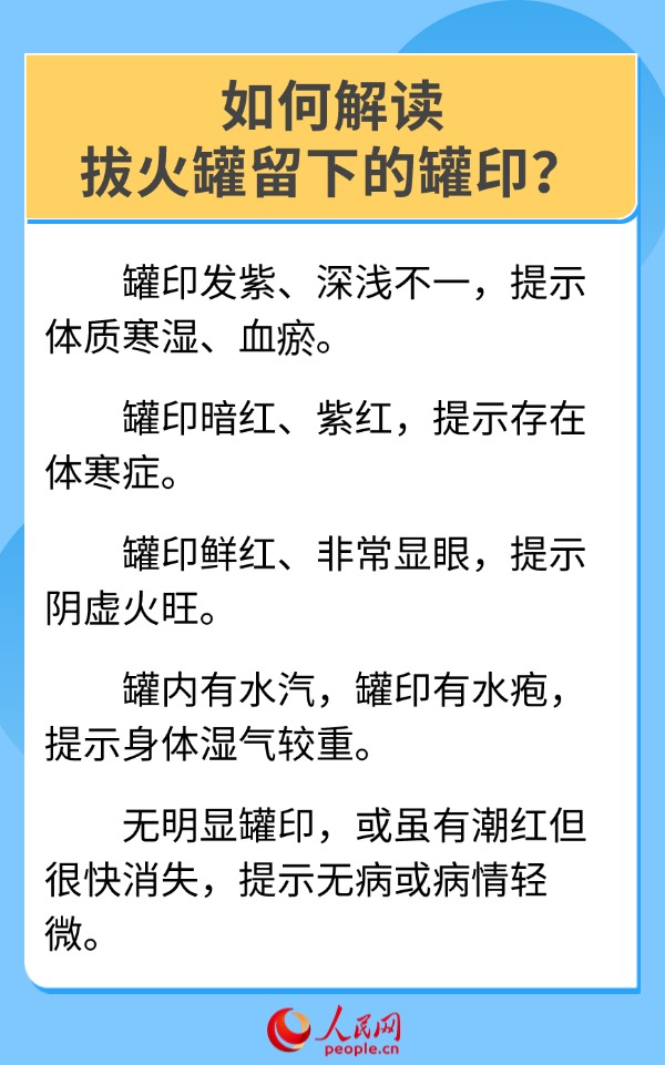 “火罐印”再现奥运会 6问6答带你了解拔罐疗法