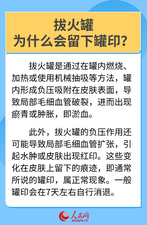 “火罐印”再现奥运会 6问6答带你了解拔罐疗法